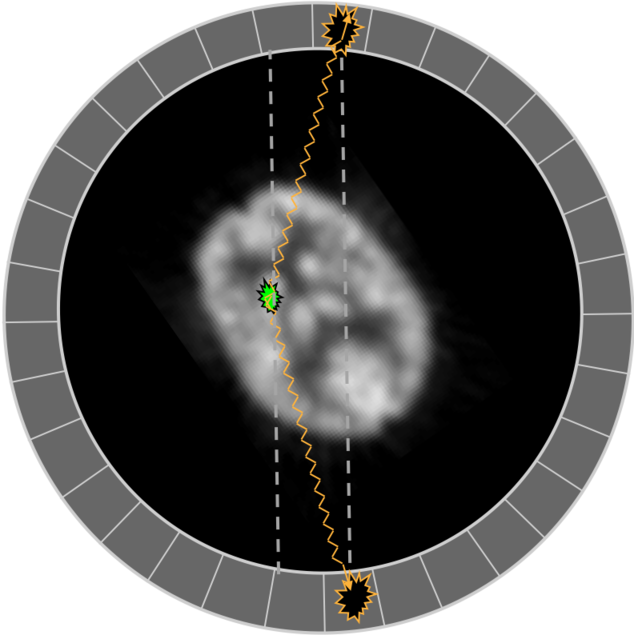 Exaggerated example of less than 180 degree collinearity