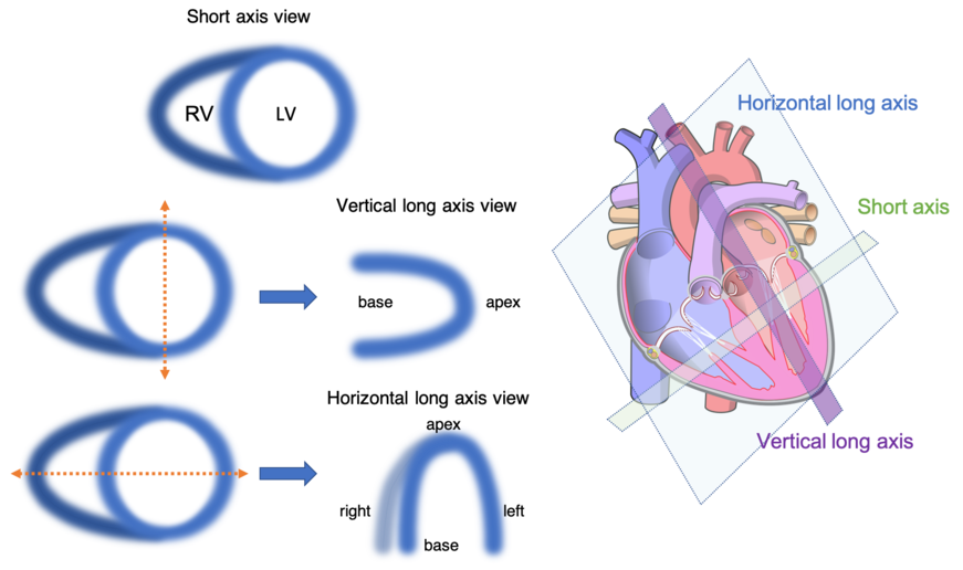 Heart image views